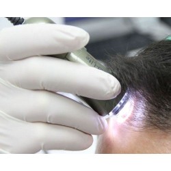 Video Tricoscop - Camera Microscopie Tricologica  - TrichoScope Video Tricoscop - Camera Microscopie Tricologica  - TrichoScope